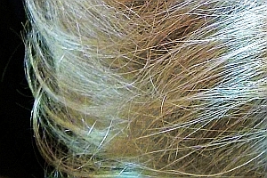 Läuse lieben Haare; Bild: Internet-ABC